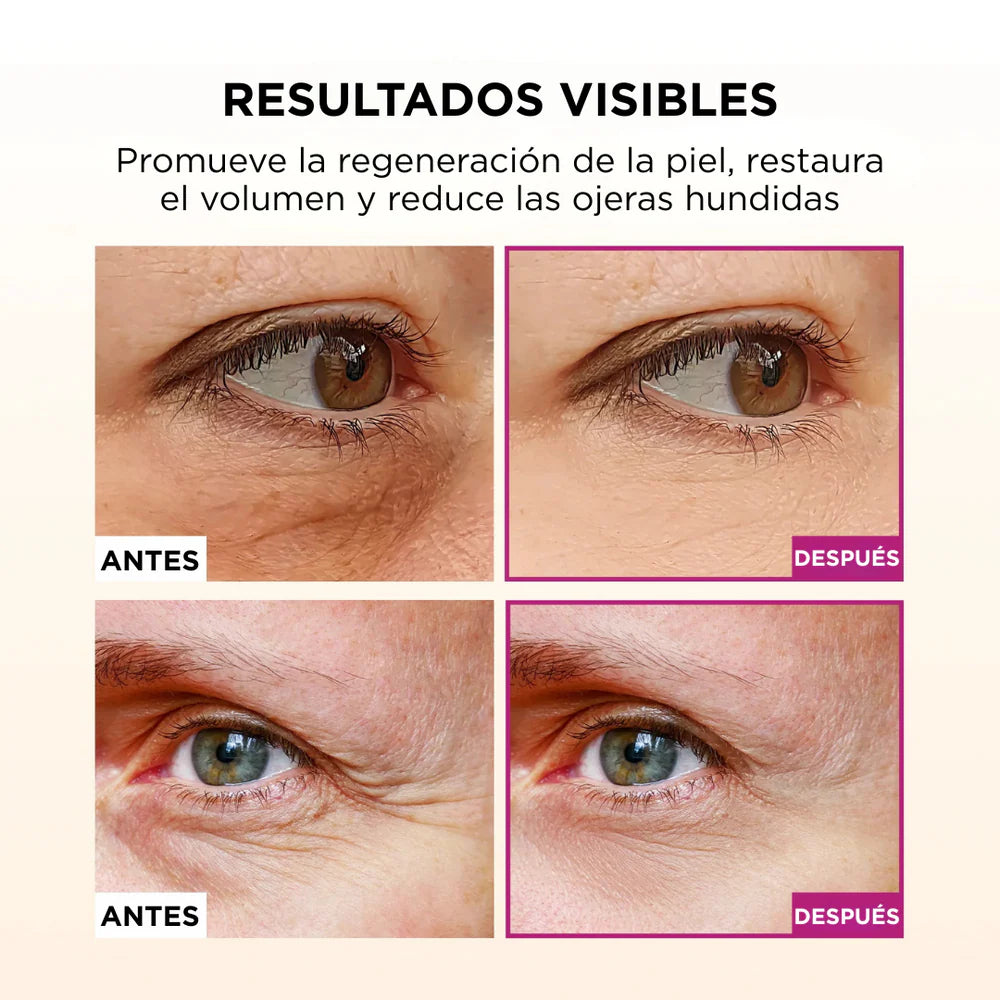 Bálsamo de Calcio - Botox en barra