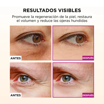 Bálsamo de Calcio - Botox en barra